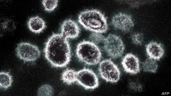 This undated handout image obtained March 28, 2021, courtesy of The National Institue of Allergy and Infectious Diseases/ NIH shows a transmission electron microscope image of SARS-CoV-2, the virus that causes Covid-19, isolated from a patient in the US, as virus particles are shown emerging from the surface of cells cultured in the lab, the spikes on the outer edge of the virus particles give coronaviruses their name, crown-like - The novel coronavirus has killed at least 2,777,761 people since the outbreak emerged in China in December 2019, according to a tally from official sources compiled by AFP at 10H00 GMT on March 28, 2021. At least 126,622,220 cases of coronavirus have been registered. The vast majority have recovered, though some have continued to experience symptoms weeks or even months later. (Photo by Handout / National Institute of Allergy and Infectious Diseases / AFP) / RESTRICTED TO EDITORIAL USE - MANDATORY CREDIT "AFP PHOTO /NATIONAL INSTITUTE OF ALLERGY AND INFECTIOUS DISEASES/NIH/HANDOUT " - NO MARKETING - NO ADVERTISING CAMPAIGNS - DISTRIBUTED AS A SERVICE TO CLIENTS