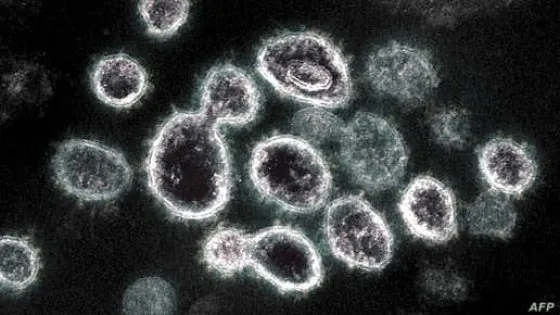 This undated handout image obtained March 28, 2021, courtesy of The National Institue of Allergy and Infectious Diseases/ NIH shows a transmission electron microscope image of SARS-CoV-2, the virus that causes Covid-19, isolated from a patient in the US, as virus particles are shown emerging from the surface of cells cultured in the lab, the spikes on the outer edge of the virus particles give coronaviruses their name, crown-like - The novel coronavirus has killed at least 2,777,761 people since the outbreak emerged in China in December 2019, according to a tally from official sources compiled by AFP at 10H00 GMT on March 28, 2021. At least 126,622,220 cases of coronavirus have been registered. The vast majority have recovered, though some have continued to experience symptoms weeks or even months later. (Photo by Handout / National Institute of Allergy and Infectious Diseases / AFP) / RESTRICTED TO EDITORIAL USE - MANDATORY CREDIT "AFP PHOTO /NATIONAL INSTITUTE OF ALLERGY AND INFECTIOUS DISEASES/NIH/HANDOUT " - NO MARKETING - NO ADVERTISING CAMPAIGNS - DISTRIBUTED AS A SERVICE TO CLIENTS