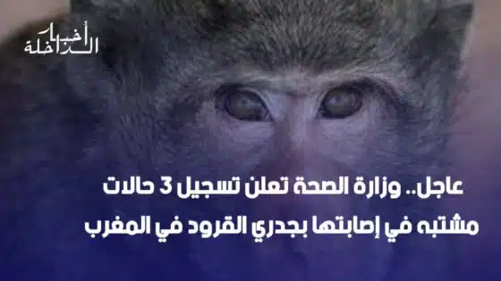 عاجل.. وزارة الصحة تعلن تسجيل 3 حالات مشتبه في إصابتها بجدري القرود في المغرب