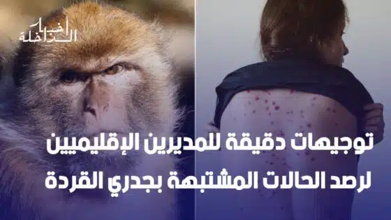 توجيهات دقيقة للمديرين الإقليميين لرصد الحالات المشتبهة بجدري القردة